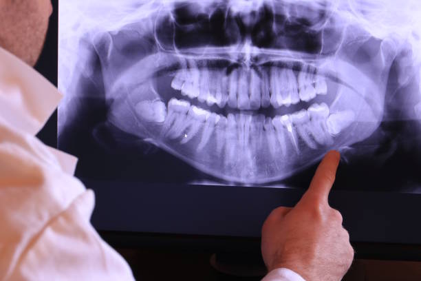 Best Dentist for Tooth Abscess  in Harkers Island, NC